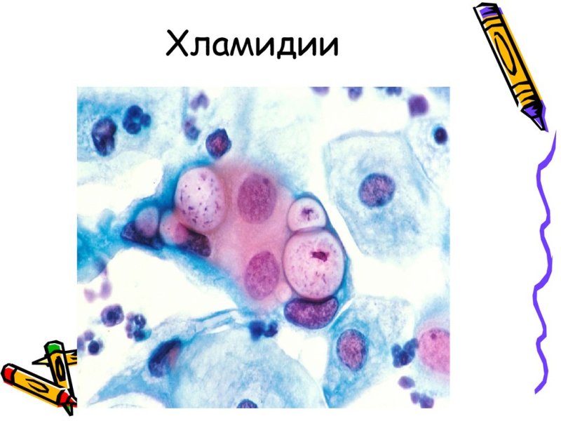 Хламидии морфология микробиология