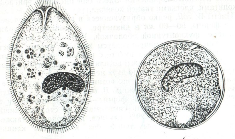 Balantidium coli, циста