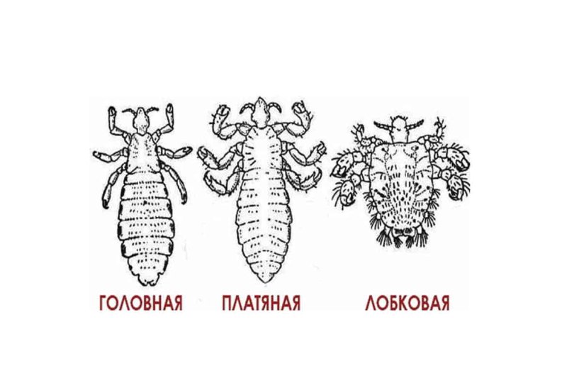 Платяная вошь рисунок строение