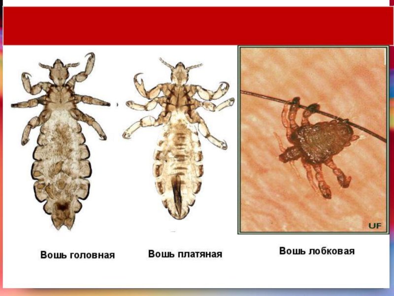 Платяная вошь рисунок строение