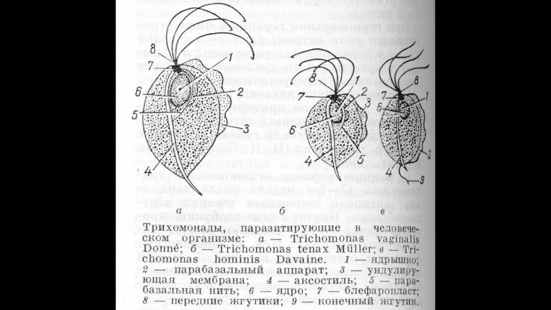 Кишечная трихомонада схема
