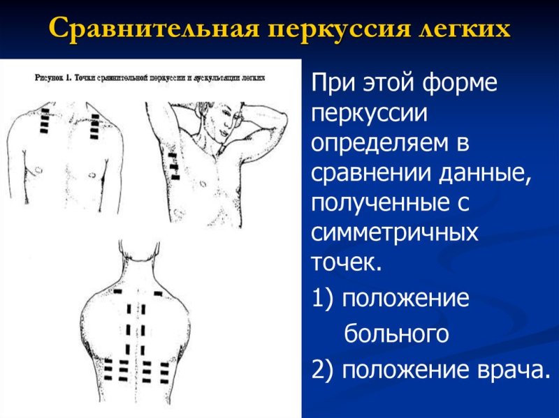 Сравнительная и топографическая перкуссия грудной клетки