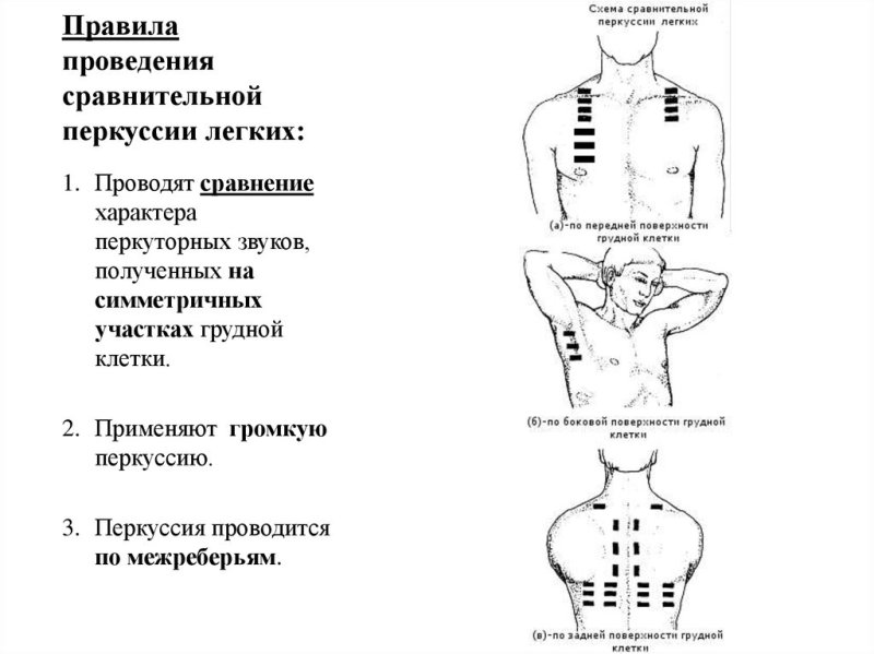 Топографическая перкуссия легких точки