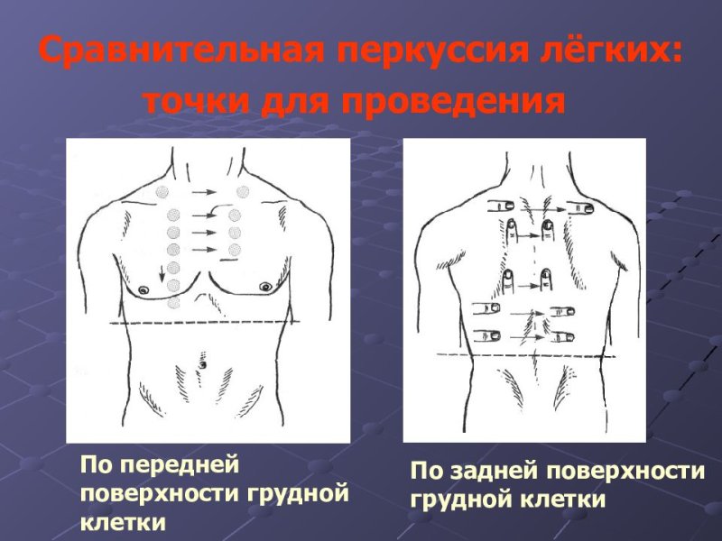 Топографическая перкуссия легких точки