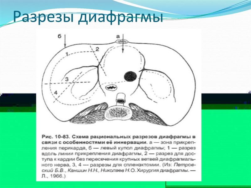 Слабые места диафрагмы схема