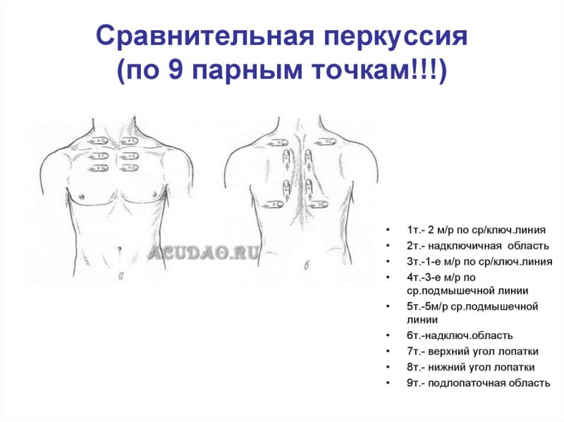 Перкуссия грудной клетки пропедевтика внутренних болезней