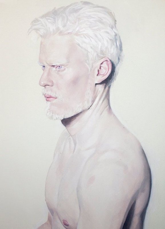 Stephen Thompson альбинос