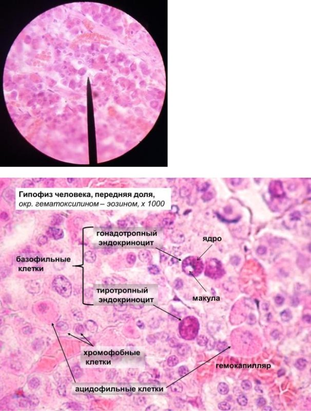 Аденогипофиз гистология препарат