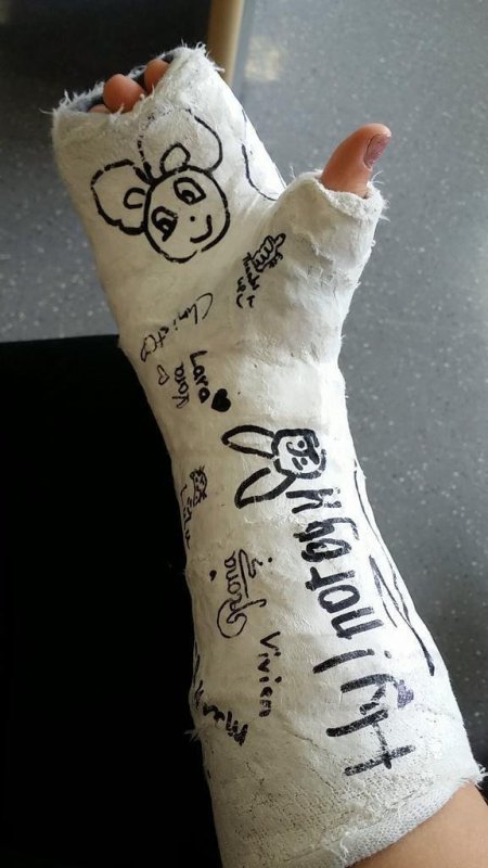 разрисованный гипс на руке