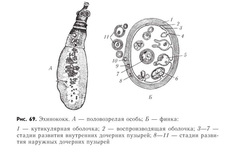 Эхинококк схема строения