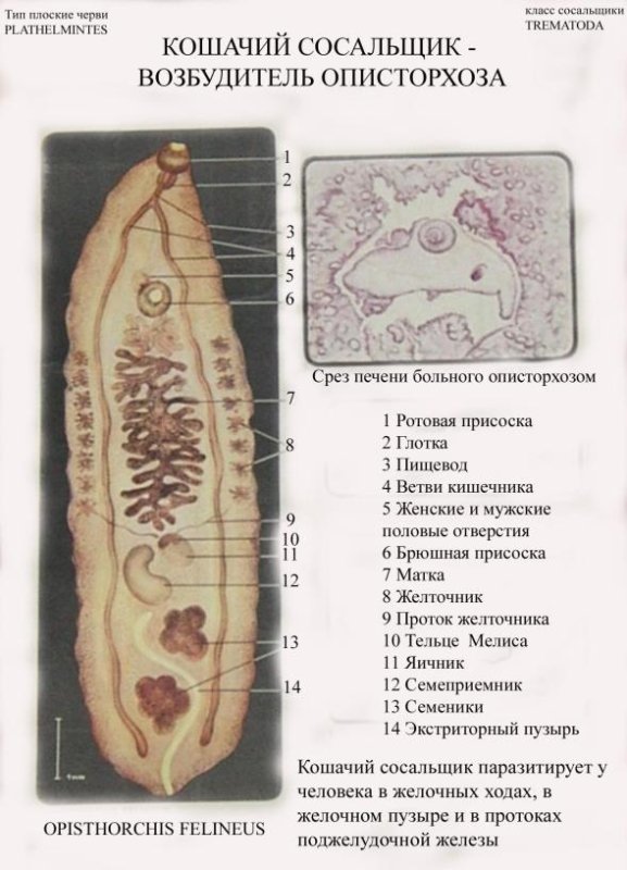 Марита Сибирского сосальщика